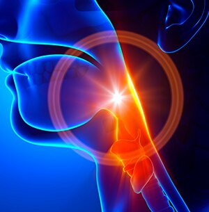 causas_disfagia_central1_1